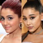 Ariana Grande Plastic Surgery: Facts, Rumors, and Transformations | PlasticSurgeryInsights.com