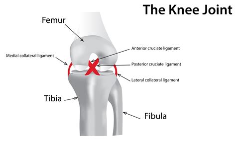 Knee Injuries – KneePain.com