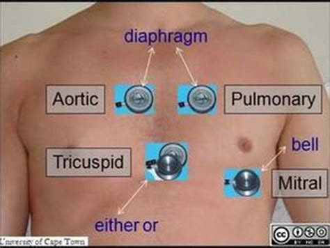 Ascultation for heart sound bell and diaphragm in - MEDizzy