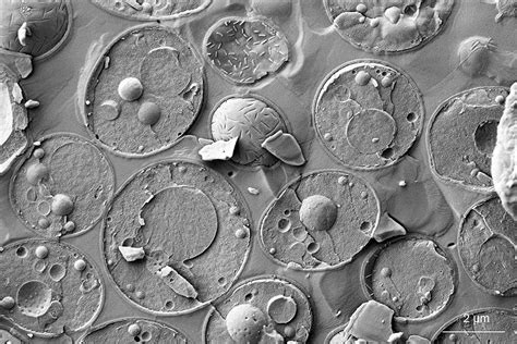 Yeast key to understanding cell division