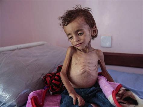 Millions of Yemenis edging closer to famine and disease, charity says | Express & Star