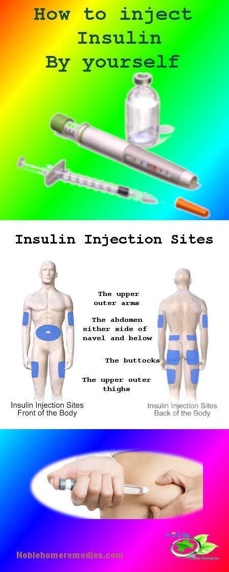 Insulin Injection Sites - Learn how to Inject - Type1 & Type2 Diabetes | Insulin injection sites ...