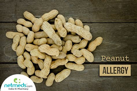 Peanut Allergy: Causes, Symptoms and Treatment