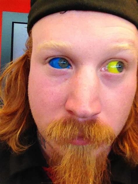 10 Extreme Eyeball Tattoos That Look Incredibly Painful