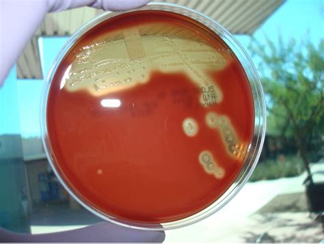 ALPHA AND BETA HEMOLYTIC STREPTOCOCCUS – Laboratory Exercises in Microbiology