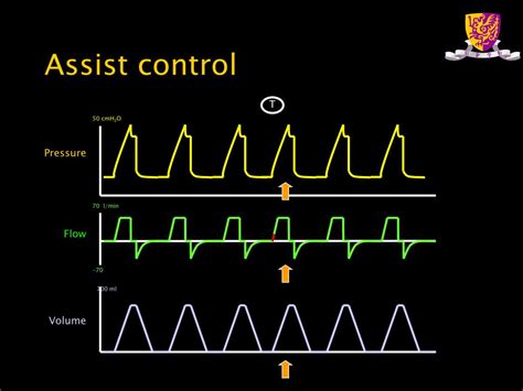 PPT - Mechanical ventilation PowerPoint Presentation, free download - ID:5798899