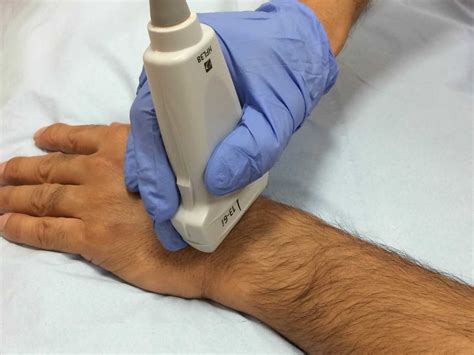 How an Ultrasound helps with the Diagnosis of Hand and Wrist Lumps?