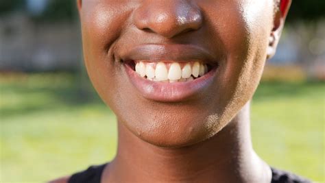 What is Carbamide Peroxide Teeth Whitening? - Dental Health Society