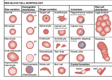 Figure 5-3 from Evaluation of Cell Morphology and Introduction to Platelet and White Blood Cell ...