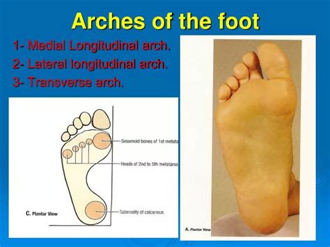 PPT - Arches of the foot PowerPoint Presentation, free download - ID ...