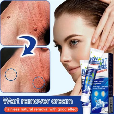 Sirf Tum 7 Wart & Skin Tag Remover Ointment - Powerful and Effective 100gm - JioMart