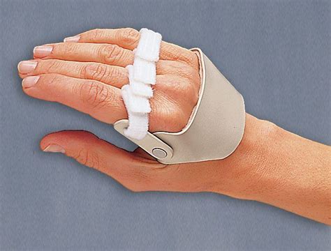 Ulnar Nerve Injury Splint