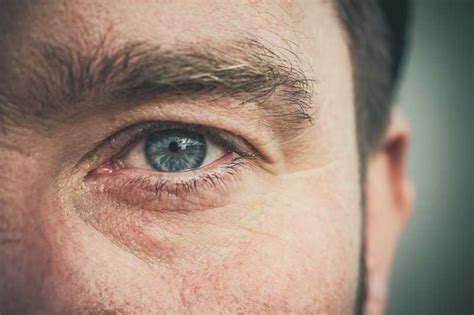 ¿Cómo quitar las antiestéticas ojeras en hombres?