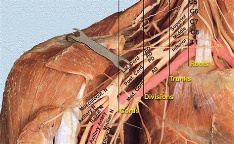 Anatomy of the Brachial Plexus - TeachMe Orthopedics