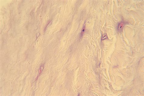 Fibrocartilage 400X 1