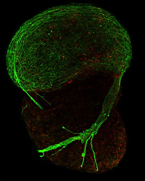 Neurone development, embryoid body | Wellcome Collection