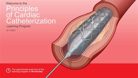 Cardiac Catheterization