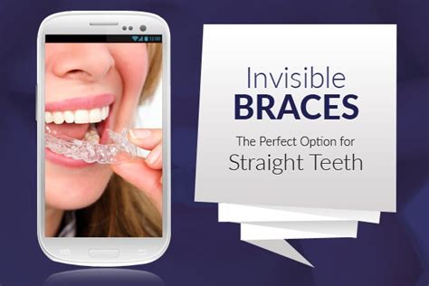 Invisible Braces to Straighten Crowded Teeth - Orthodontics Treatment in UK