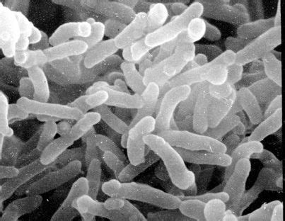 Corynebacterium - microbewiki | Medical branches, Eukaryotic cell, Microbiology lab