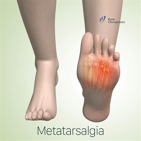 #Metatarsalgia is not an injury; it's actually a symptom or a group of symptoms. These may ...