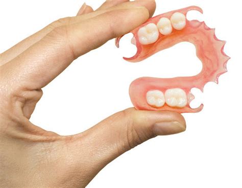 Removable Partial Denture Philippines