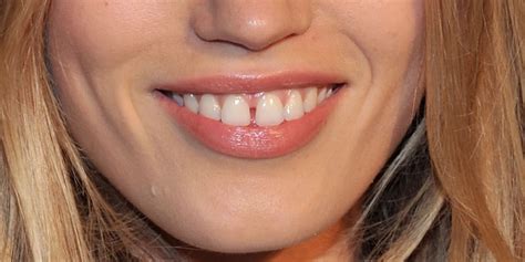 How To Close Gap In Teeth At Home - Dakota Johnson Reveals Why Her ...