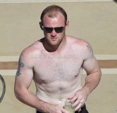 Fashion's World: Wayne Rooney Hair Transplant