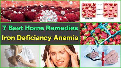 7 Best Home Remedies for Anemia Iron Deficiency Natural Remedies Anemia ...