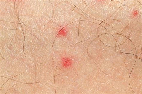 Pinpoint red dots on skin causes - tdfreeloads