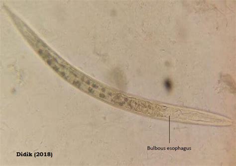 Enterobius Vermicularis In Urine Treatment