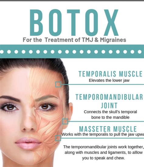 Botox for TMJ - Robinson Dentistry