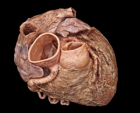 Cadaver heart superior view Diagram | Quizlet