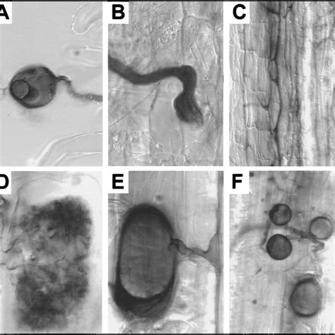 (PDF) Arbuscular mycorrhiza: Biological, chemical, and molecular aspects