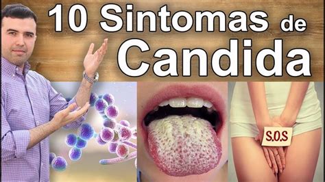 Sinais e Sintomas De Candidíase - 10 Avisos Importantes de Uma Infecção ... em 2020 | Candidiase ...