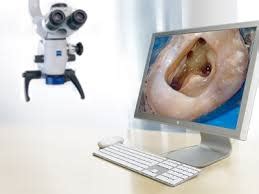 Endodontic Microscope London | Consultation £59 | Endodontist London & Root Canal Treatment ...