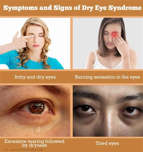 Dry Eye Syndrome Causes Symptoms Of Chronic Dry Eye