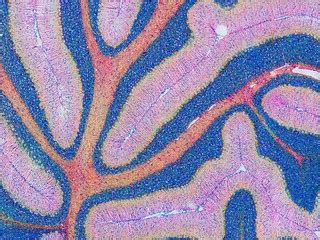 Mouse cerebellum in pink and blue | The cerebellum is the br… | Flickr