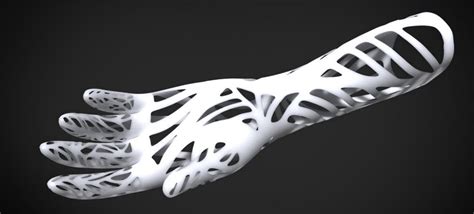 Cocreat3D Creates Aesthetically Pleasing 3D Printed Prosthetic Hands