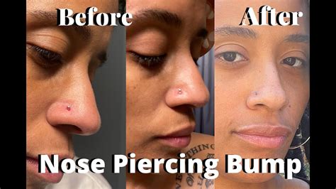 Bumps On Nose Piercing Competitive Price | saratov.myhistorypark.ru