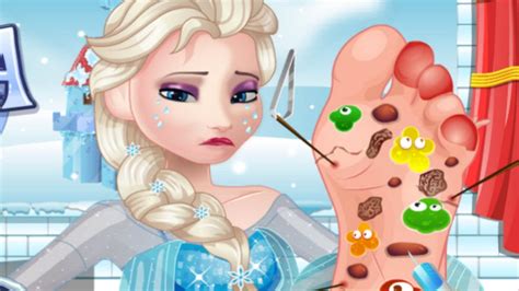 Frozen Princess Elsa - Elsa Foot Doctor Game - Baby Games, Girls Games To Play - Disney Frozen ...