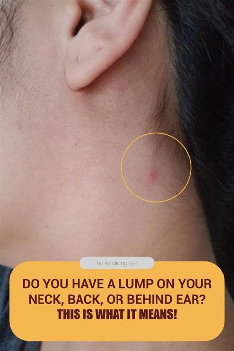 Do You've got A Lump On your Neck, Back, Or Behind Your Ear? This really is What It Means # ...