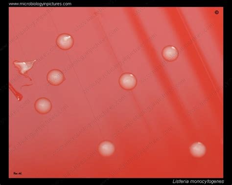 Listeria monocytogenes cell morphology. Gram stain and cell arrangement ...