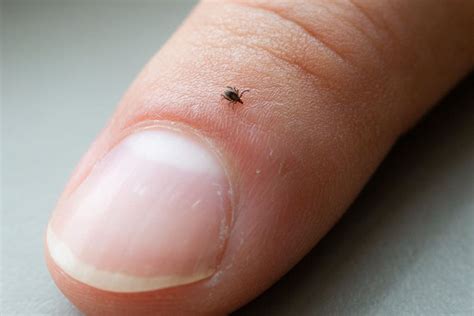 Ticks and Lyme disease