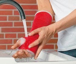 Waterproof Cast - Direct To Patients | Waterproof casts, Arm cast, It cast