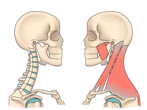 Neck Pain - Ilminster Osteopathy