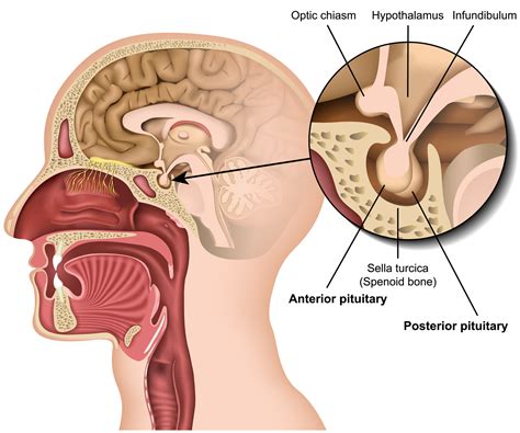 Understanding Pituitary Disorders | Brain Institute | OHSU