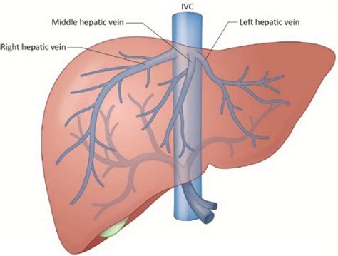 Hepatic venous vasculature. Right, middle, and left hepatic veins drain... | Download Scientific ...