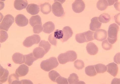 Free picture: blood smear, old, immature, schizont, plasmodium malariae