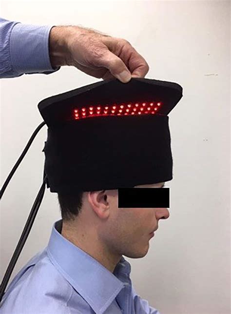 Light therapy improves cognitive function after traumatic brain injury - Research Outreach