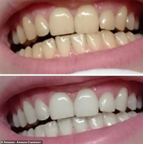 Deal alert! The bestselling Crest teeth whitening strips will whiten ...